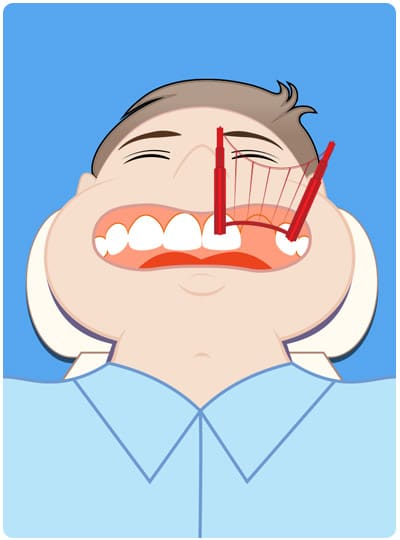 Dental Bridges West Houston TX